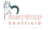 Baby Bump Sheffield